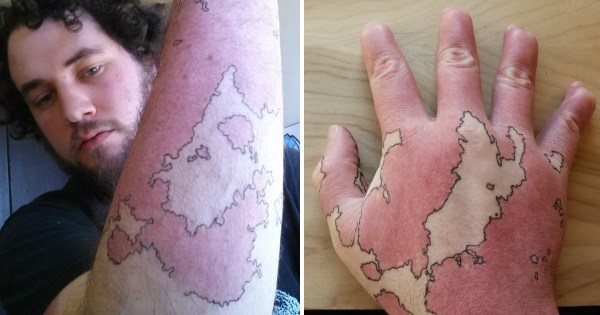 Man Turns His Birthmark Into A Birthmap And It Looks Totally Awesome