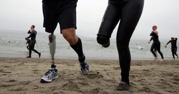 Meet The Transabled People Who Cut Off Their Limbs To Become Disabled