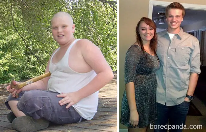 People Are Sharing Their “Ugly Duckling” Transformations And They Are