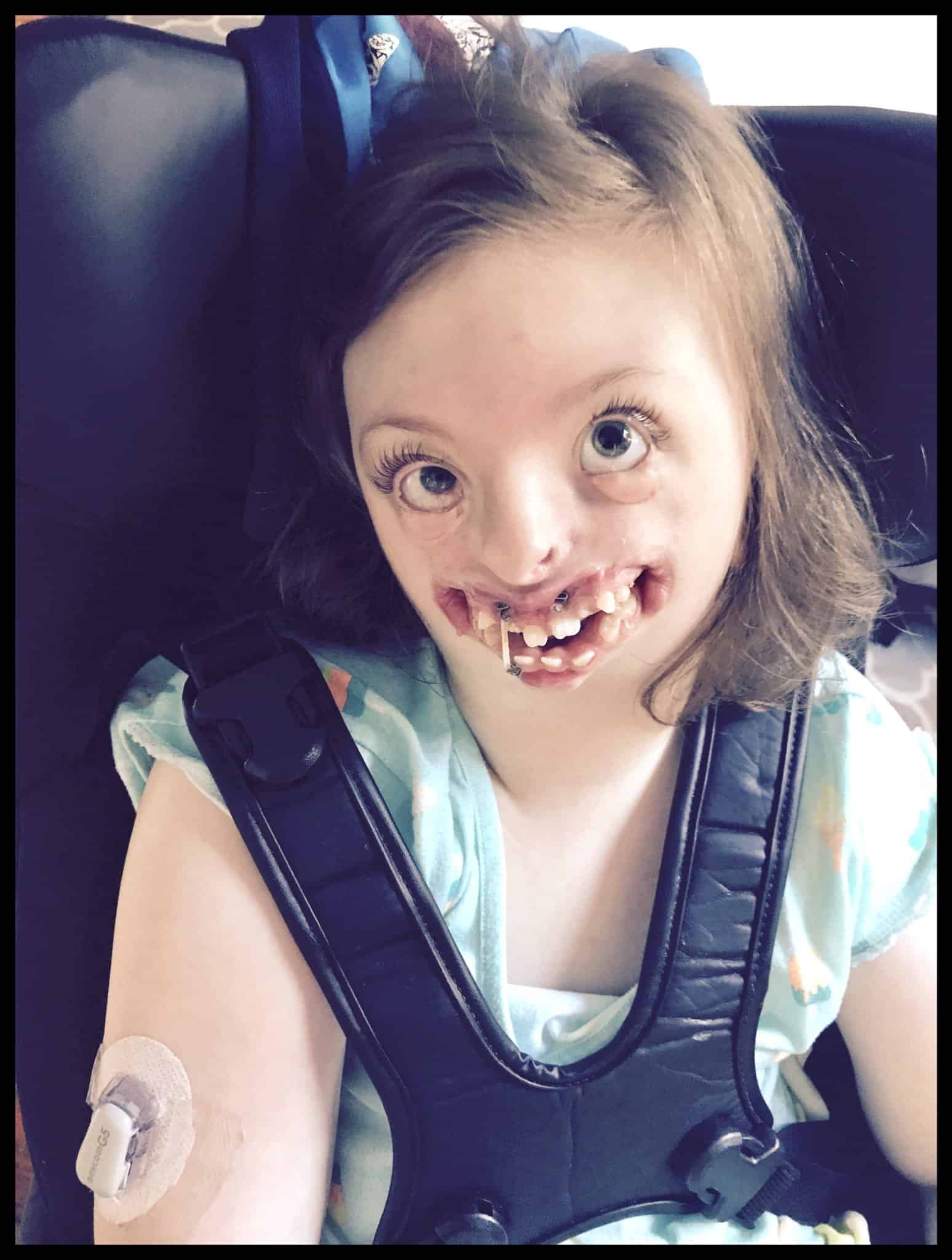 9-Year-Old Girl's Face Was Used To Promote Abortion And This Is How Her ...