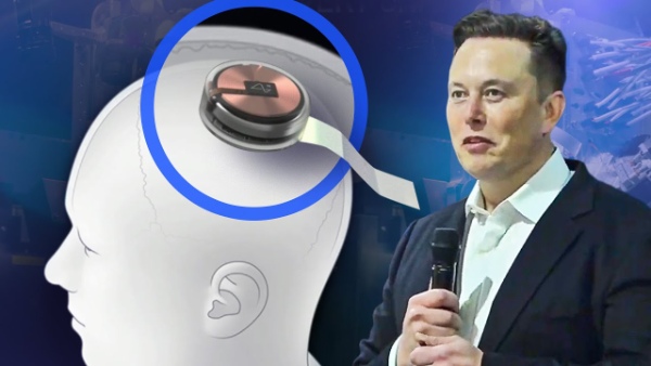 Elon Musk To Get Neuralink Brain Implant Pulptastic