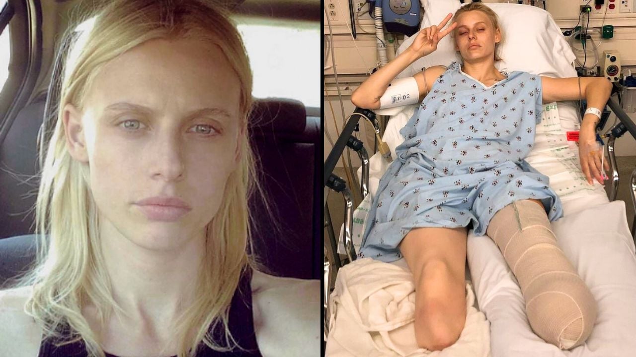 Woman Loses Both Her Legs And Almost Dies After Using Tampon Correctly