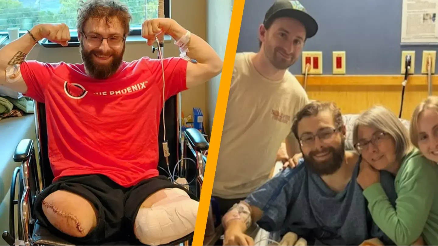 Man Loses Legs Minutes Into First Day At New Job, Survives By ‘Miracle ...