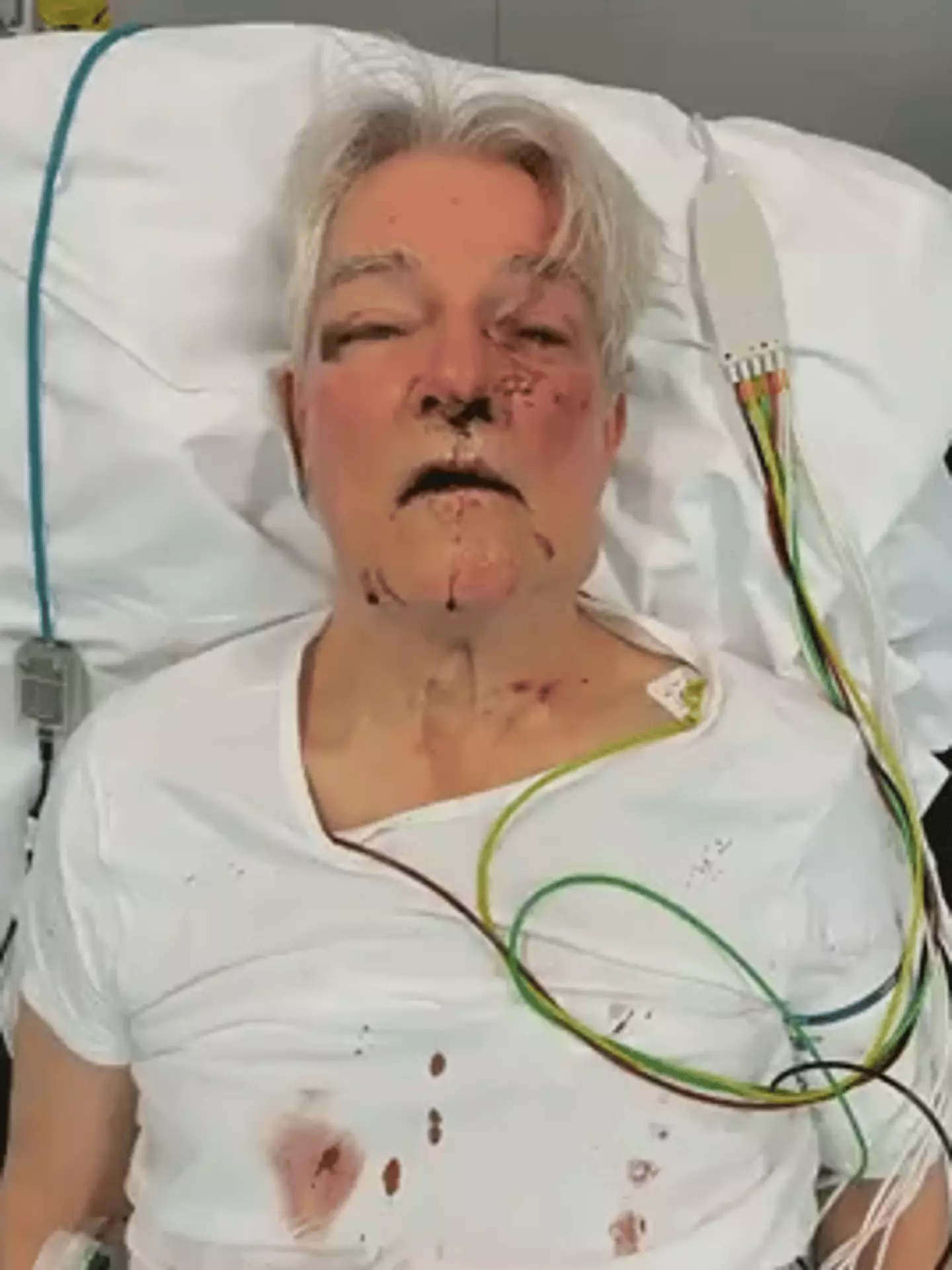 Jan Beulenkamp chose to die by euthanasia (Opsporing Verzocht)