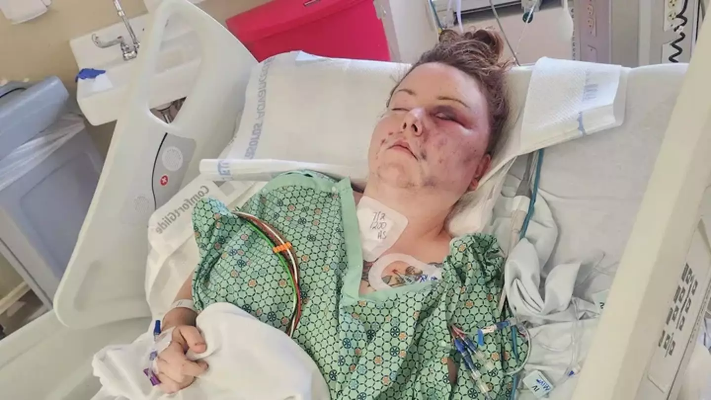 Tessa Mowel was allegedly attacked by her husband (GoFundMe)