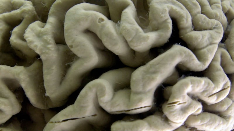 Study shows a blood test can help identify healthy people at high risk for Alzheimer’s disease