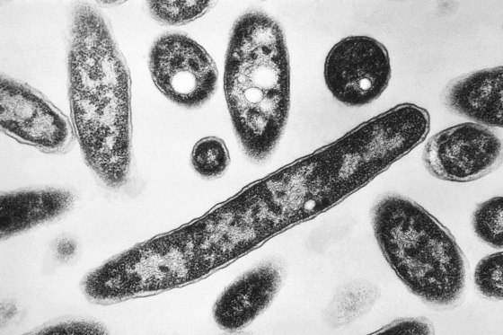7th person dies in NYC Legionnaires’ disease outbreak
