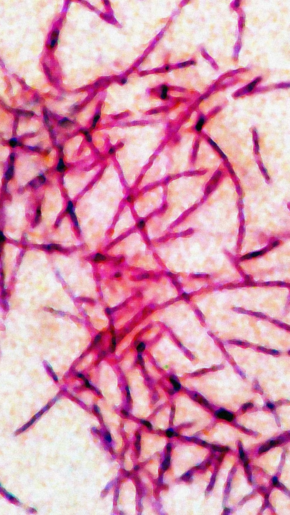 Harlem Hospital cooling tower, one of two identified sources of the outbreak