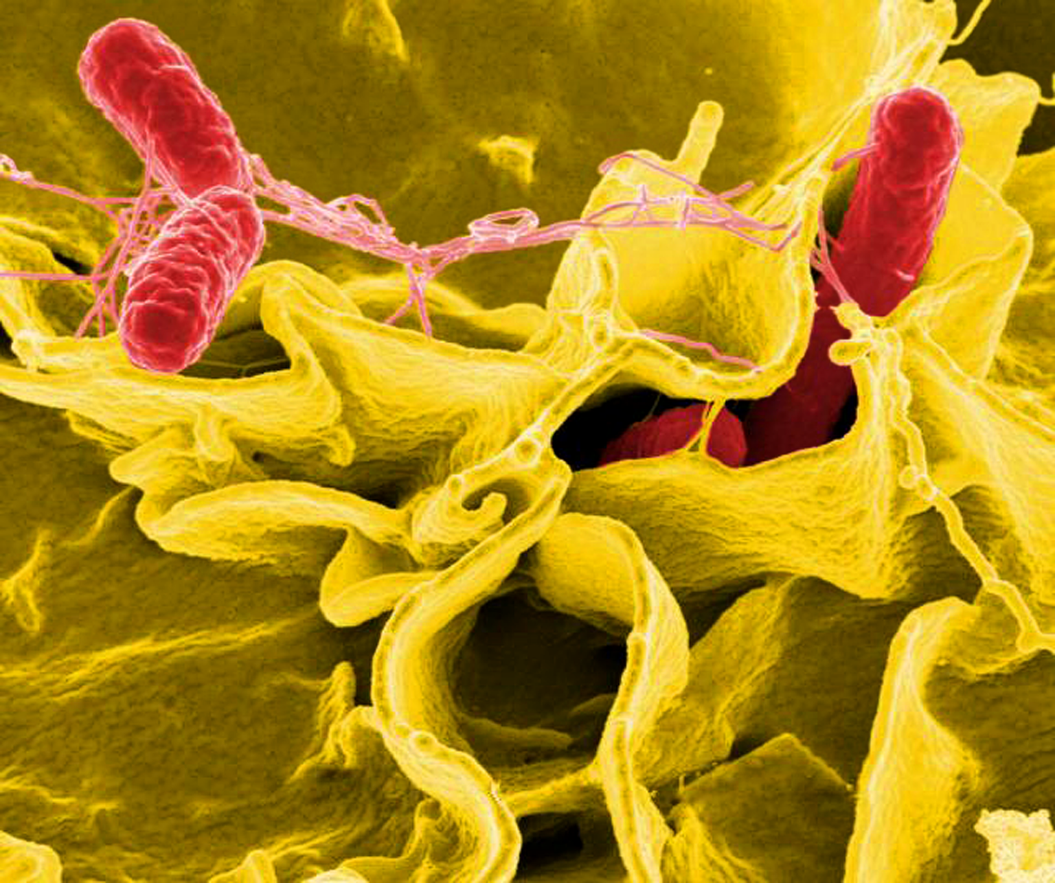Medical professional discussing salmonella symptoms with patient