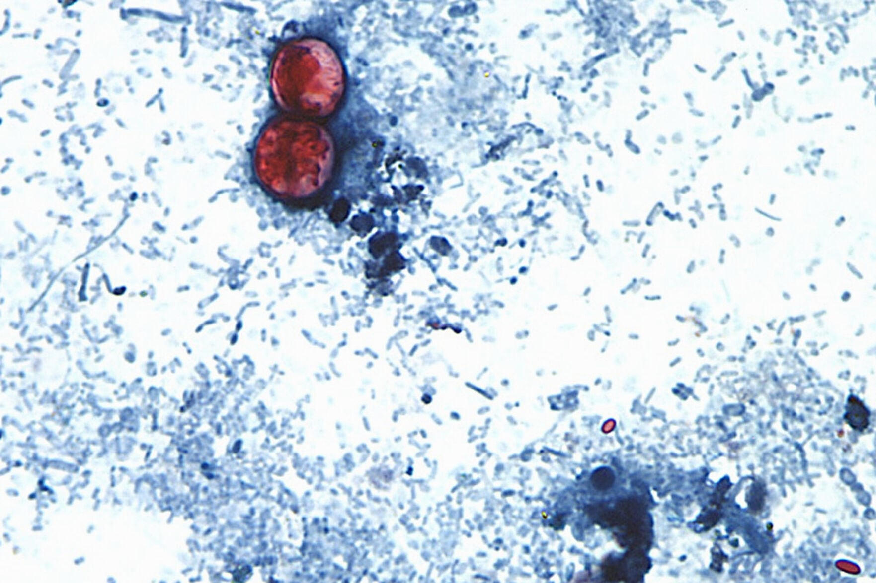 Foodborne illnesses at restaurant chains are rare but can sicken customers