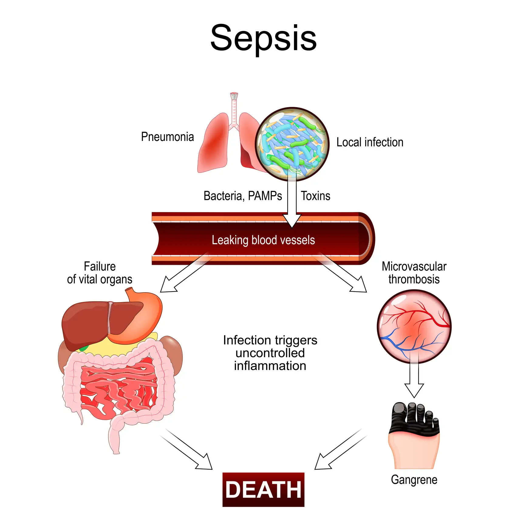 Man who had near-death sepsis experience details the warning signs he noticed