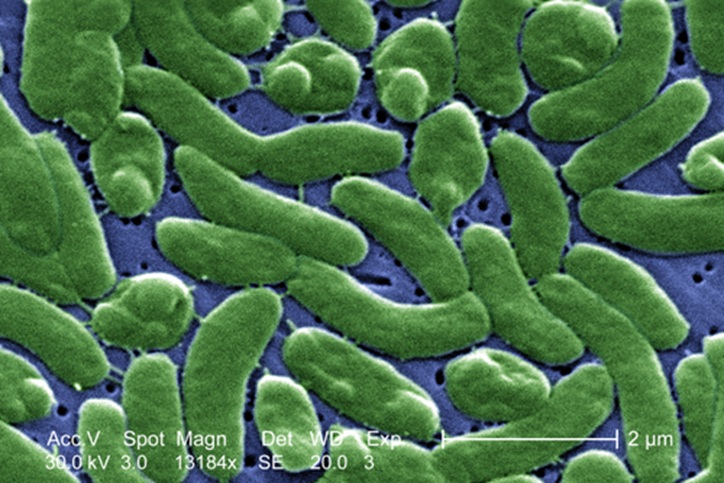 Woman who 'lost a lot of her leg' to flesh-eating bacteria issues warning to people swimming in the ocean