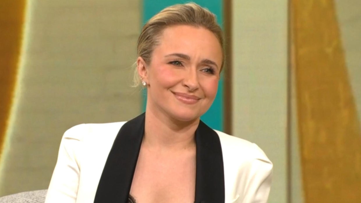 Listen to Hayden Panettiere 911 dispatch audio as cops called to ‘cardiac arrest’ and ‘overdose’
