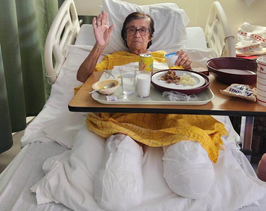 California mom has both legs amputated after car hits restaurant in Boyle Heights