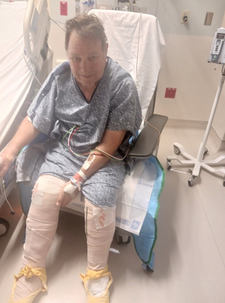 Las Vegas tourist set to have both legs amputated after tripping on scorching sidewalk that burned his body