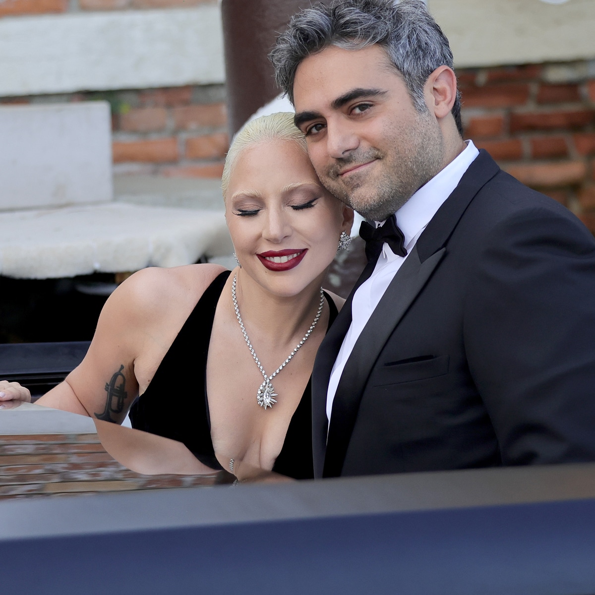 Lady Gaga’s fiancé is training AI to keep human skin tissue alive outside the body