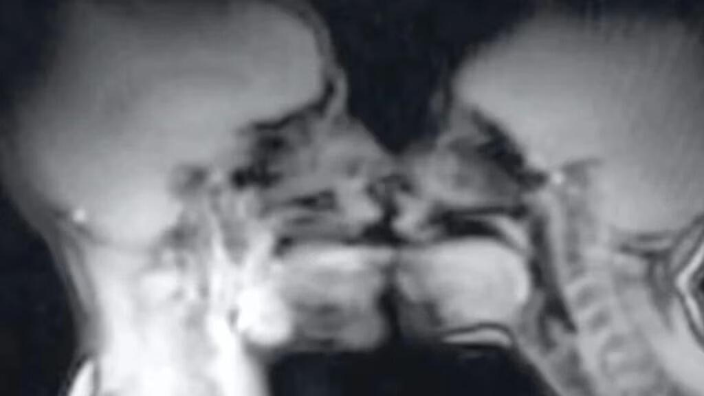 Man and woman had sex in MRI scan machine to show everything that happens
