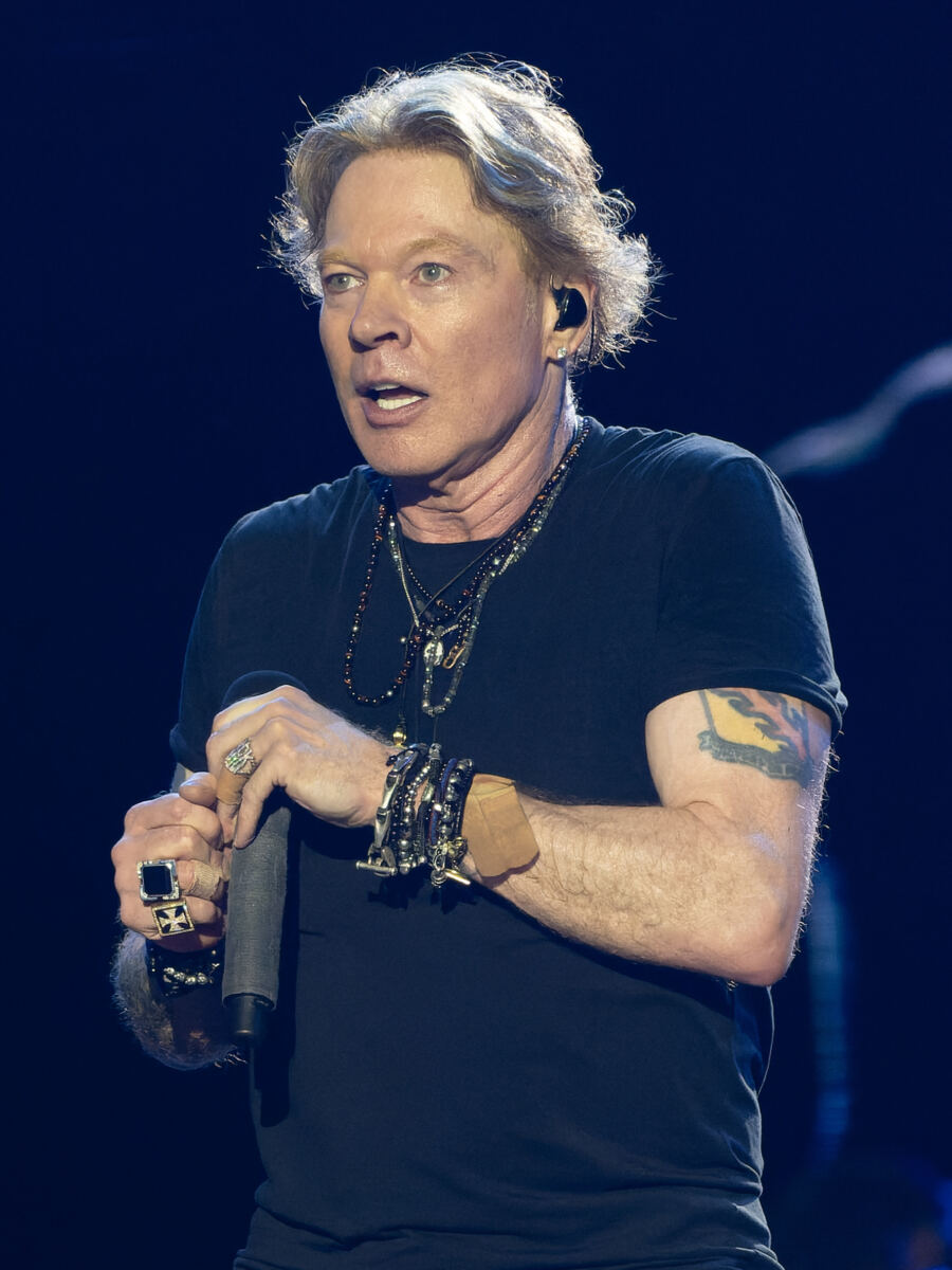 Guns N’ Roses frontman Axl Rose opens up about painful battle with severe TMJ condition