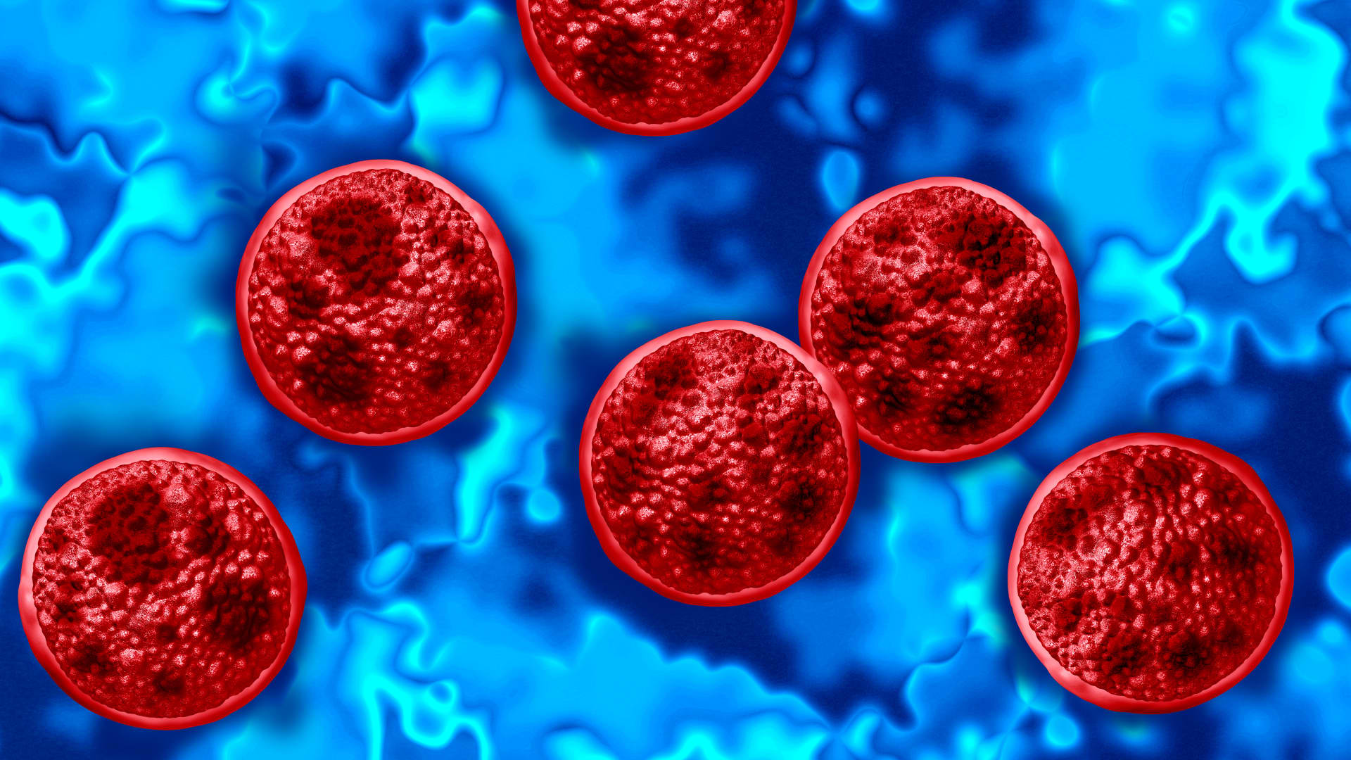 Michigan reports first 2 US deaths in outbreak of cyclospora