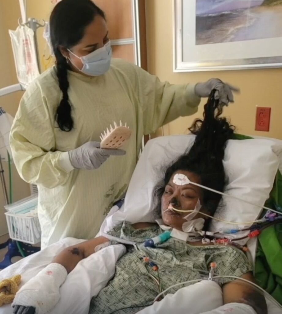 San Diego woman, 41, has arms and legs amputated after routine checkup went horribly wrong