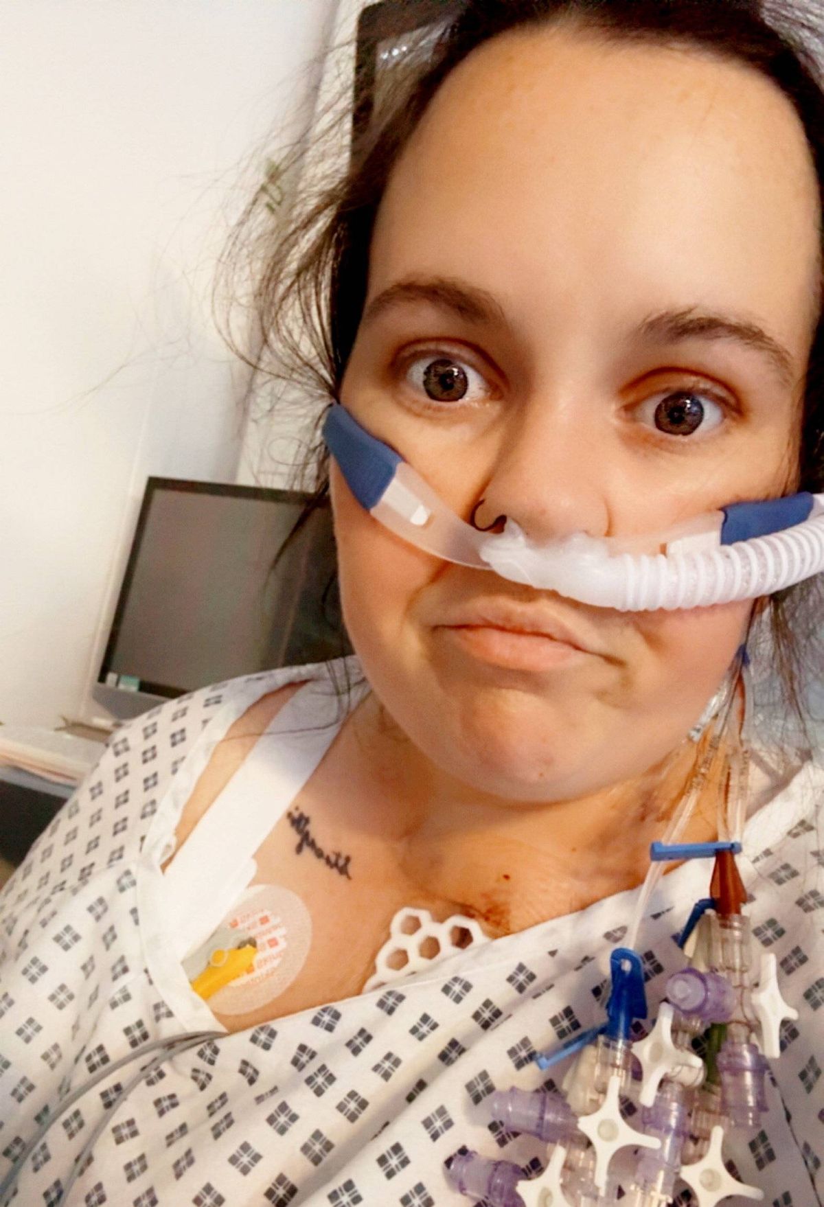 Mom's painful symptoms dismissed by doctors as anxiety turned out to be rare condition