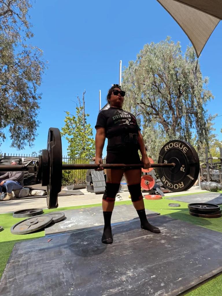 San Diego woman, 41, has arms and legs amputated after routine checkup went horribly wrong