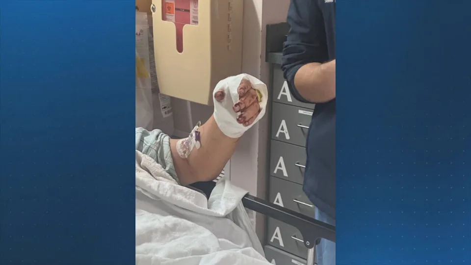 Patient stabbed home health aide in fight over oxygen mask inside posh NYC apartment: sources