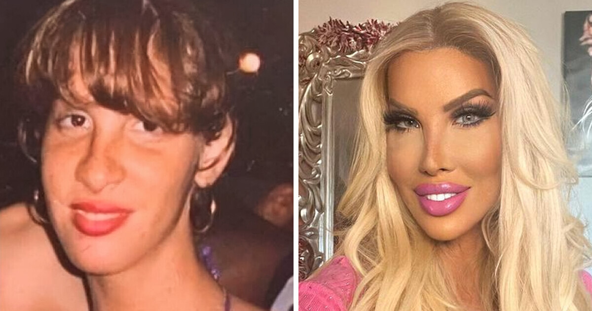 What woman who spent thousands on more than 40 procedures to look like ‘Barbie’ looked like before