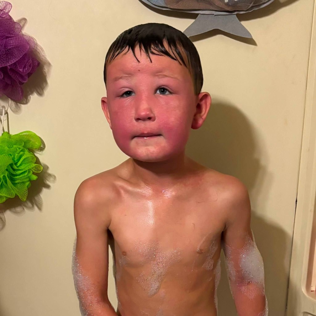 Midwest boy, 7, nearly dies over poisonous weeds in his backyard