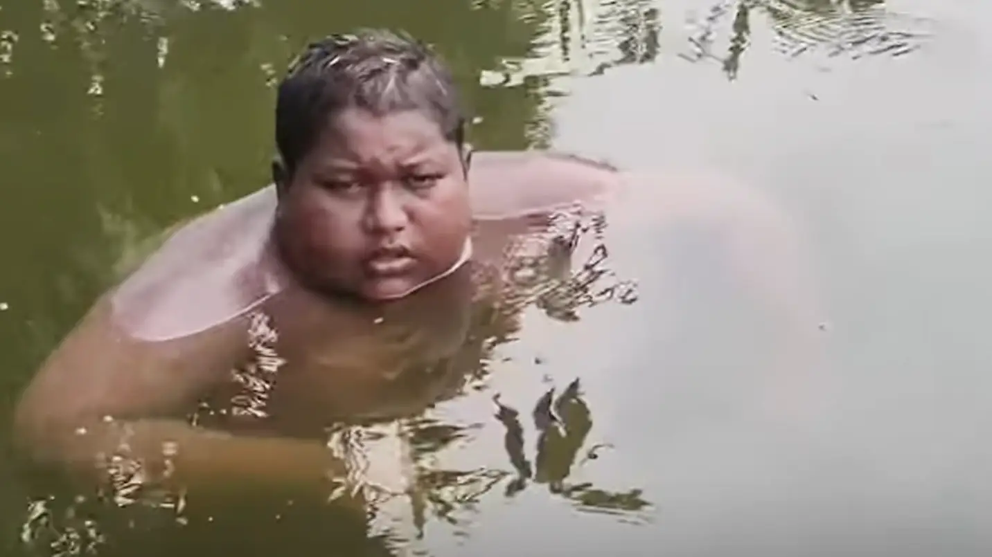 16-year-old boy has been ‘living in a pond’ for five years with mystery condition