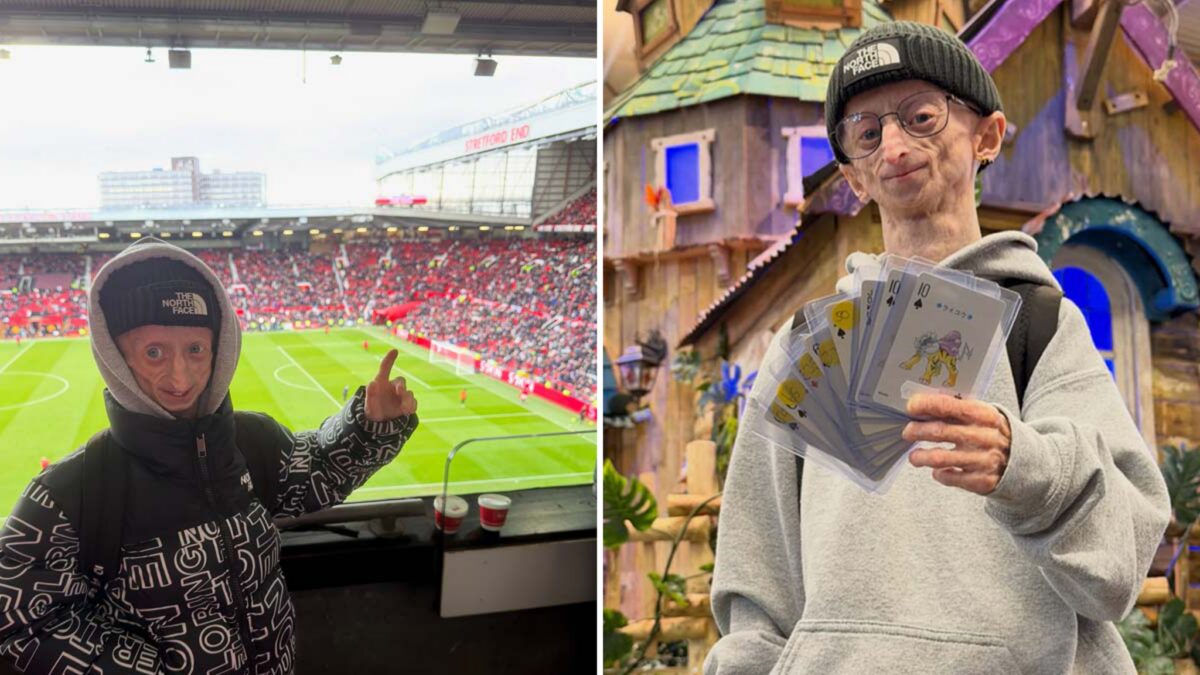 Influencer Michiel Vanderweert with rare genetic disease that causes rapid ageing dies aged 28