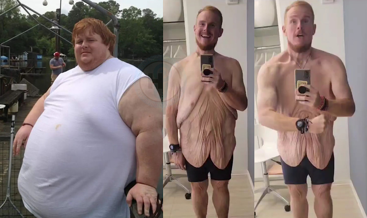 Family by the Ton star Casey King looks completely different after shedding nearly 600 pounds