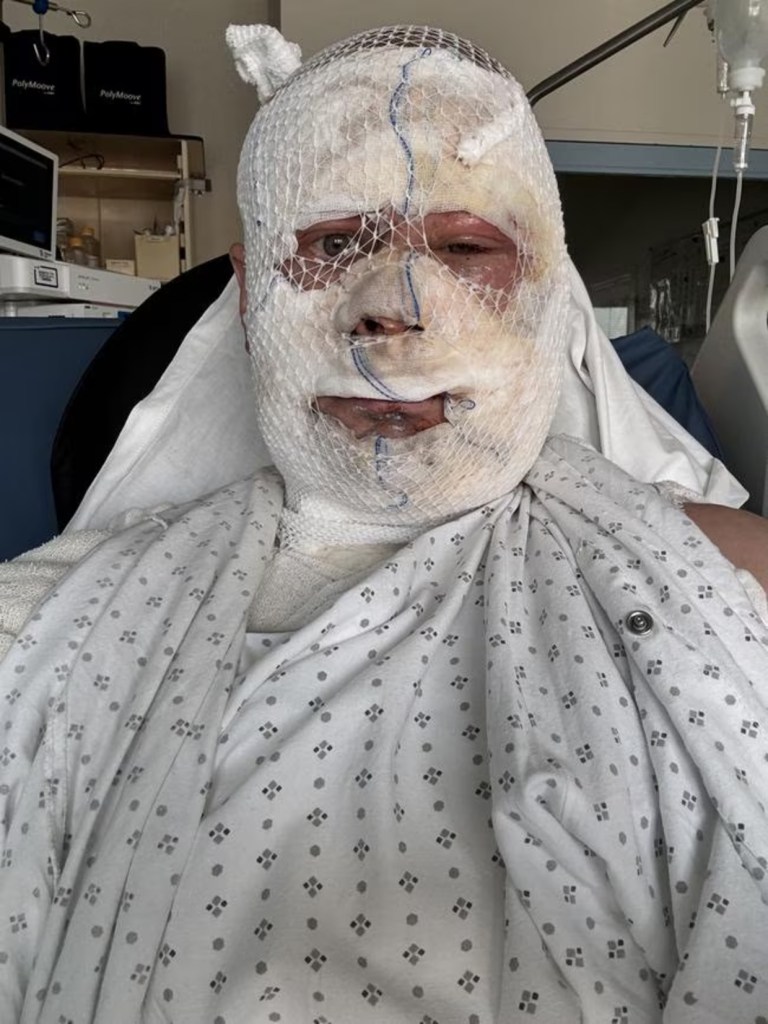 Entrepreneur shows shocking photo after his lover allegedly attacked him in luxury French villa