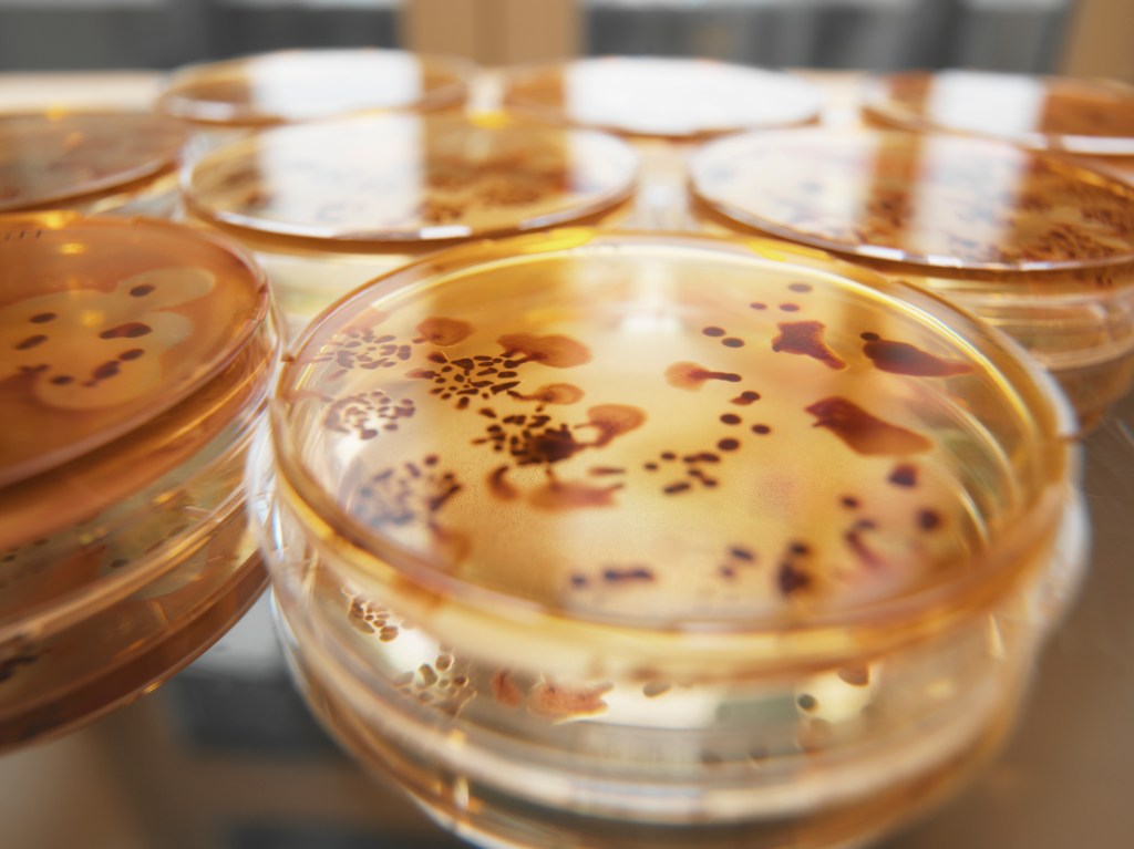 Chicago woman hospitalized after Wendy’s ‘bacteria-tainted’ double cheseburger: lawsuit