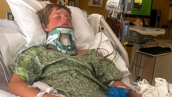 Teen lifeguard suffers devastating spinal injury in freak California training accident