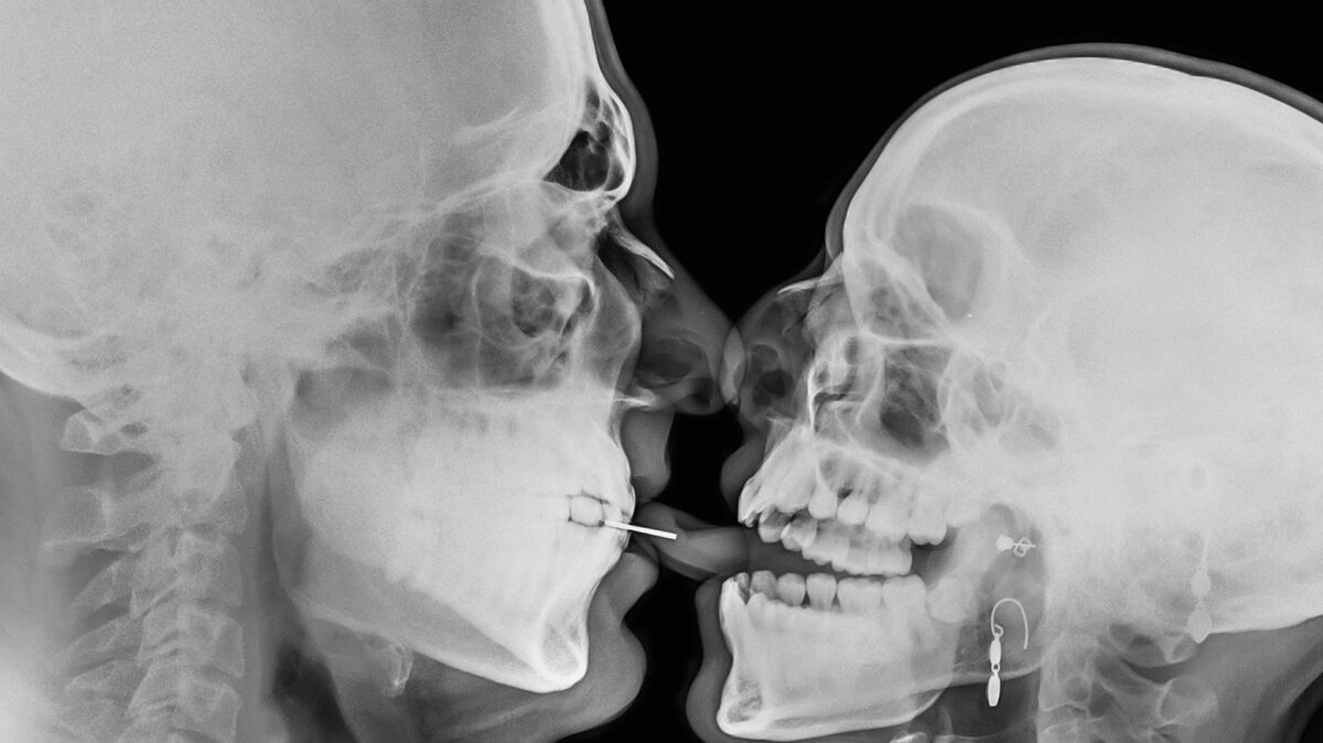 Man and woman had sex in MRI scan machine to show everything that happens