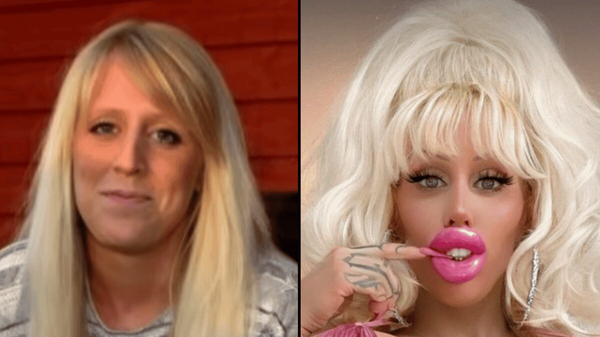 What woman who spent thousands on more than 40 procedures to look like ‘Barbie’ looked like before