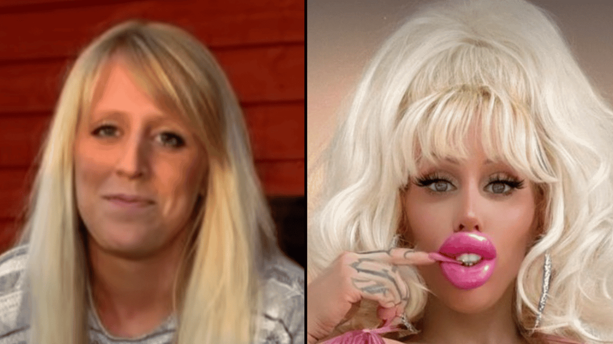 What woman who spent thousands on more than 40 procedures to look like ‘Barbie’ looked like before