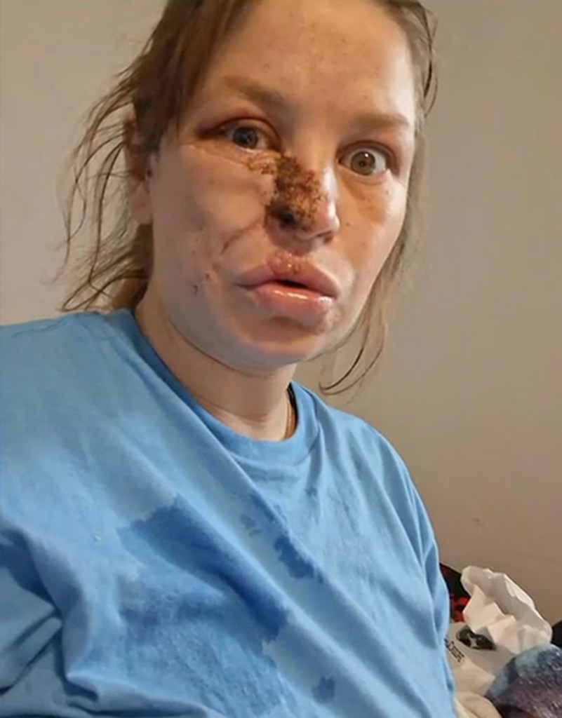 Pregnant woman needed ‘face put back together’ after savage attack by neighbor’s pit bulls: ‘Almost cost three lives’