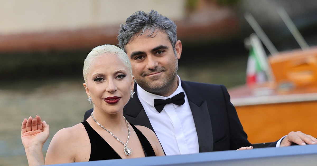 Lady Gaga’s fiancé is training AI to keep human skin tissue alive outside the body