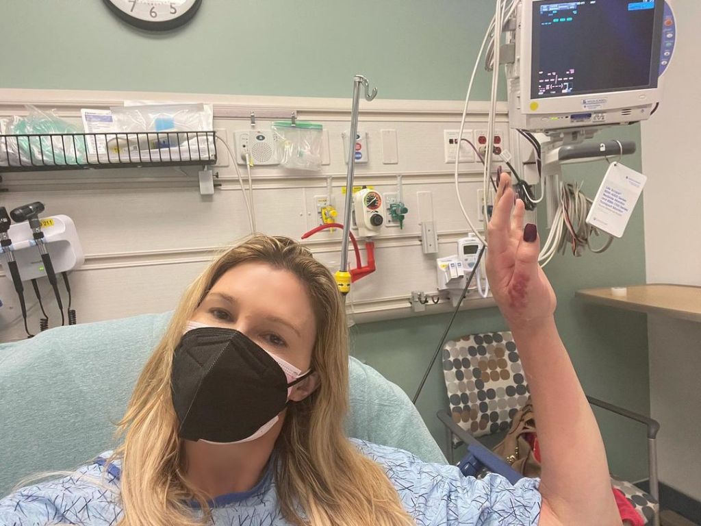 Brandi Glanville saw ‘something alive’ and ‘moving’ in her face in horrifying ultrasound