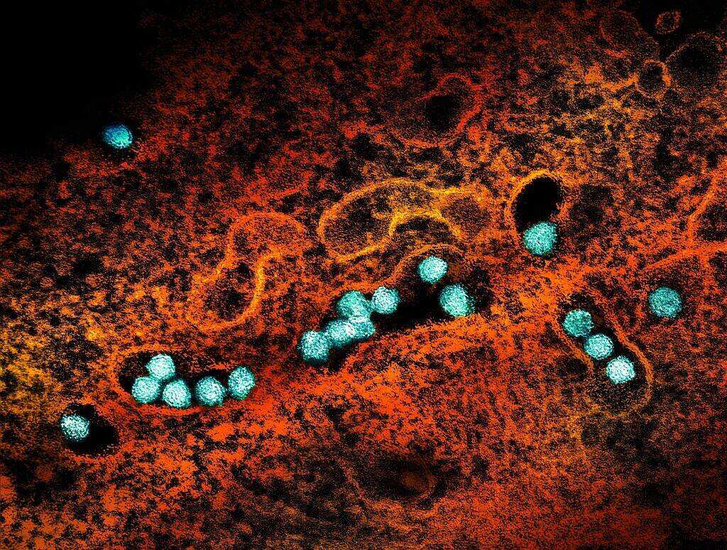 Cases of West Nile virus soar in NYC, surpassing total number in 2025
