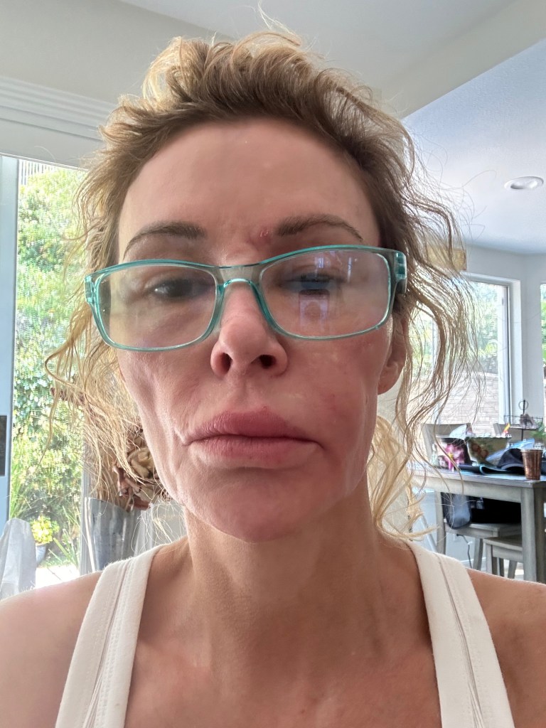 ‘Embarrassed’ Brandi Glanville breaks down in tears over GoFundMe: ‘I never thought I would do this’