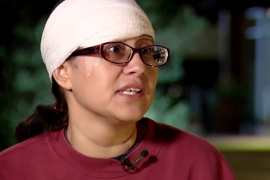 Woman accused of biting chunk out of victim’s forehead in ‘zombie bite’ attack