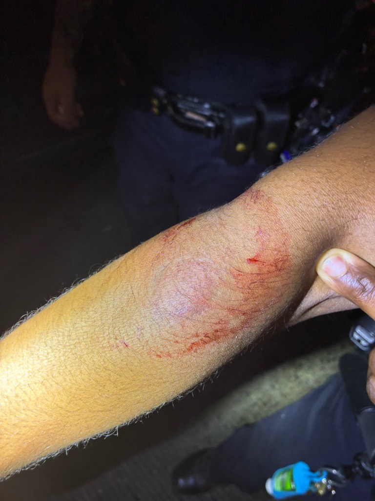NYC judge fails to take a bite out of crime after repeat offender chomps on cop