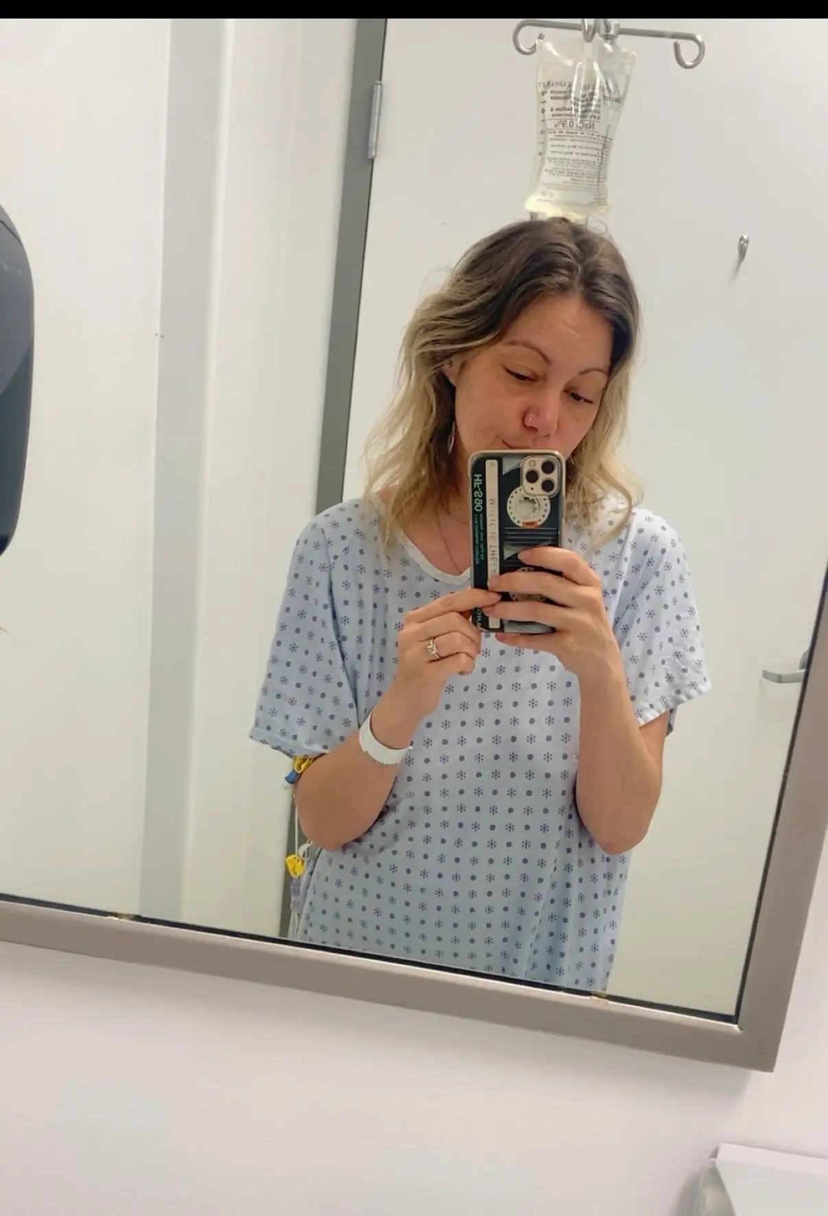 Woman diagnosed with Stiff Person Syndrome at 30 says first symptom caused her to 'wake up screaming'