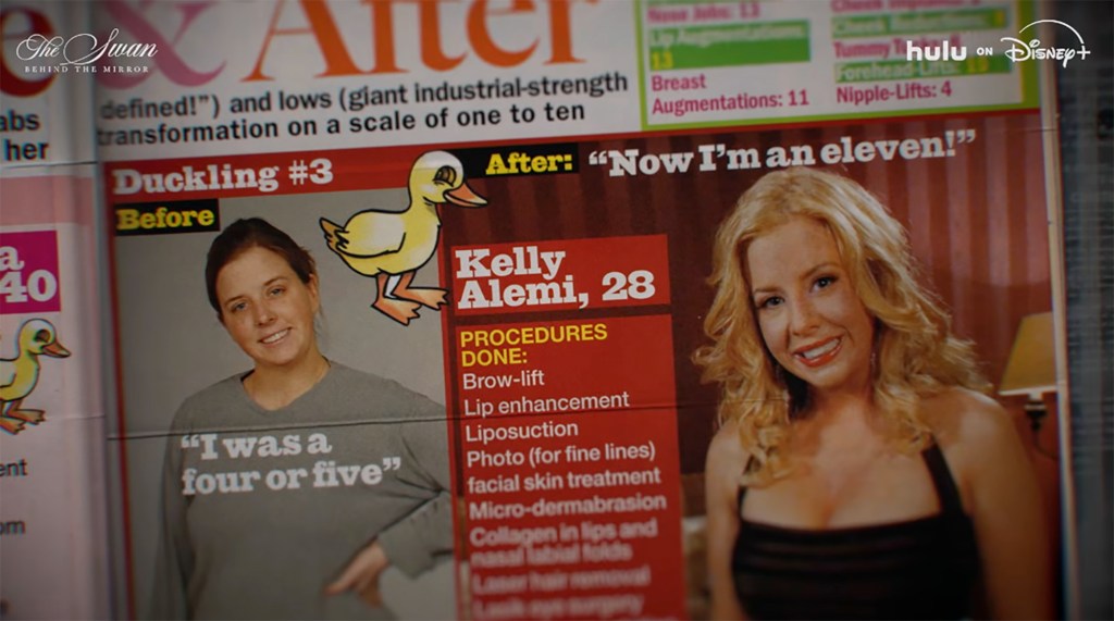 Former ‘Swan’ contestants detail the horrors behind ‘most sadistic’ reality show: ‘I almost died’