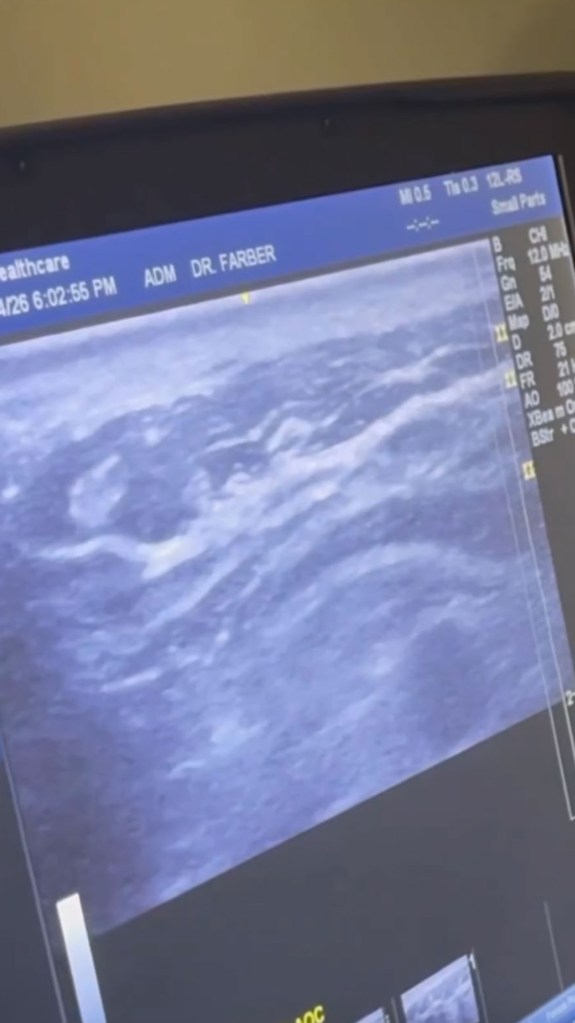 Brandi Glanville saw ‘something alive’ and ‘moving’ in her face in horrifying ultrasound
