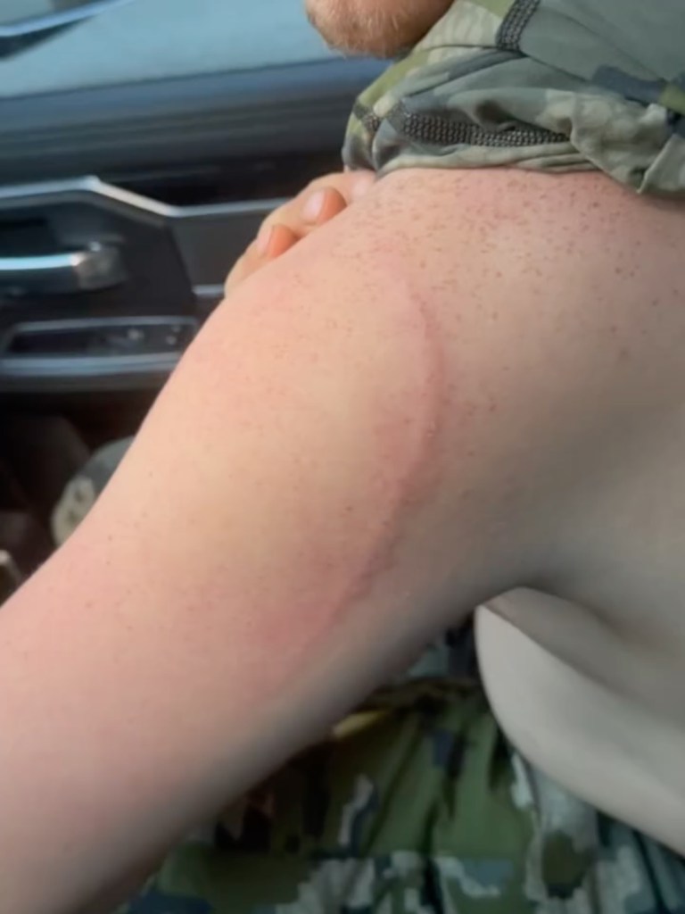 Alaska moose hunter remarkably survives bear attack: ‘Glad I blacked out’