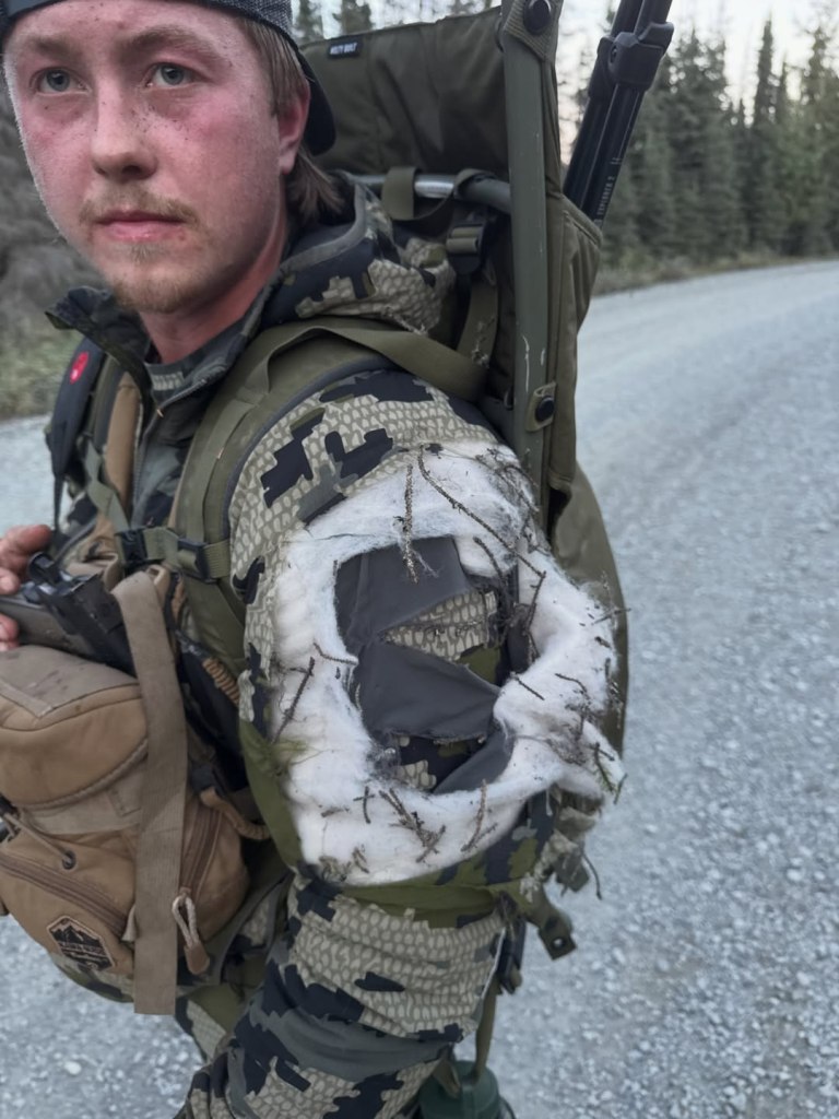 Alaska moose hunter remarkably survives bear attack: ‘Glad I blacked out’